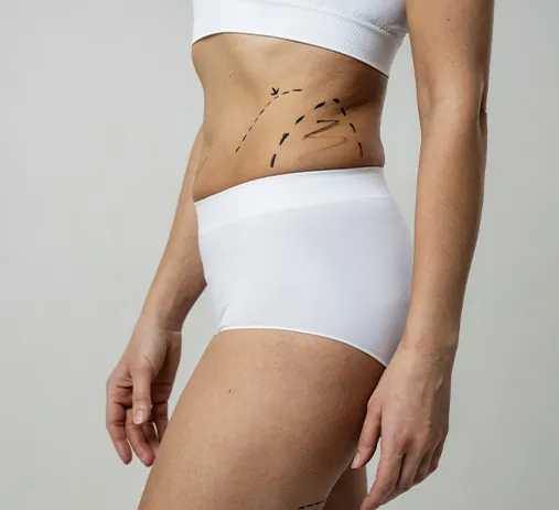 Microagulhamento Corporal