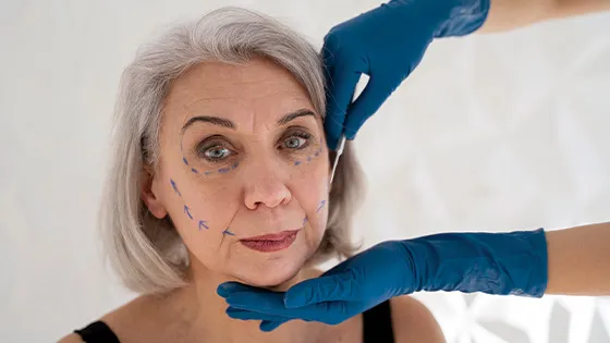 Redefina Seu Contorno com Lipo Enzimática Facial